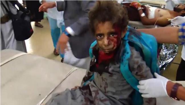 沙特联军空袭也门击中一辆校车 致多名儿童死亡
