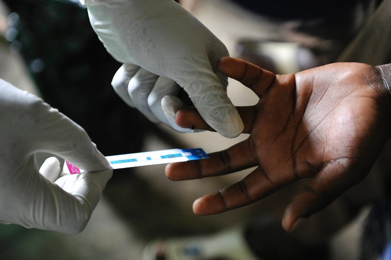 特朗普削减预防艾滋项目基金 至少一百万人要死在非洲